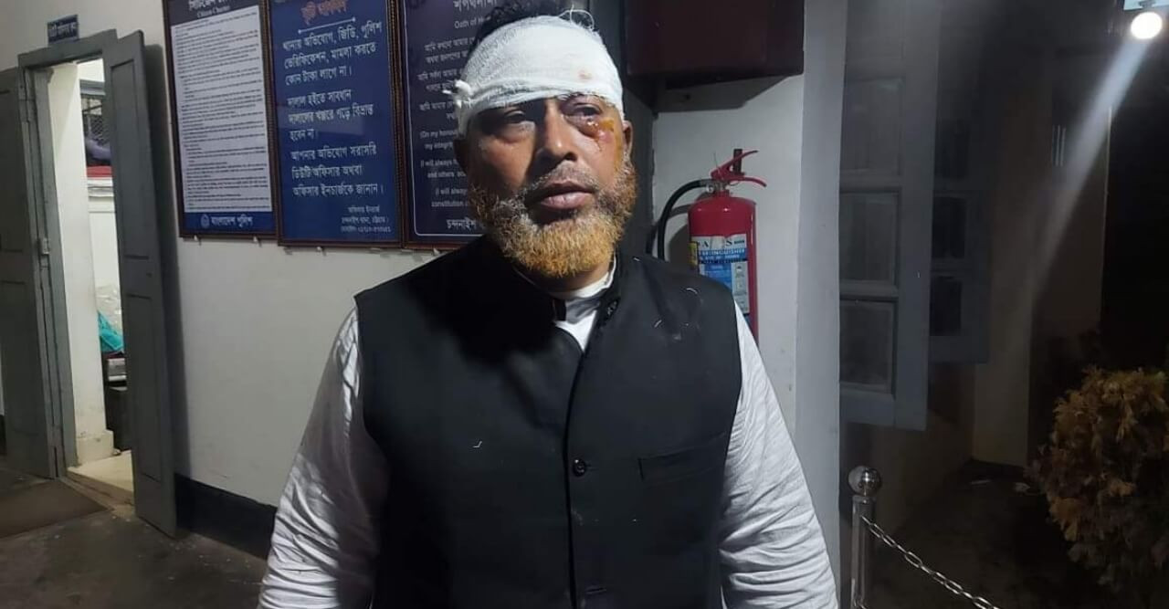 চন্দনাইশে বিক্ষিপ্ত কিছু ঘটনার মধ্য দিয়ে ইউ'পি নির্বাচন সম্পন্ন
