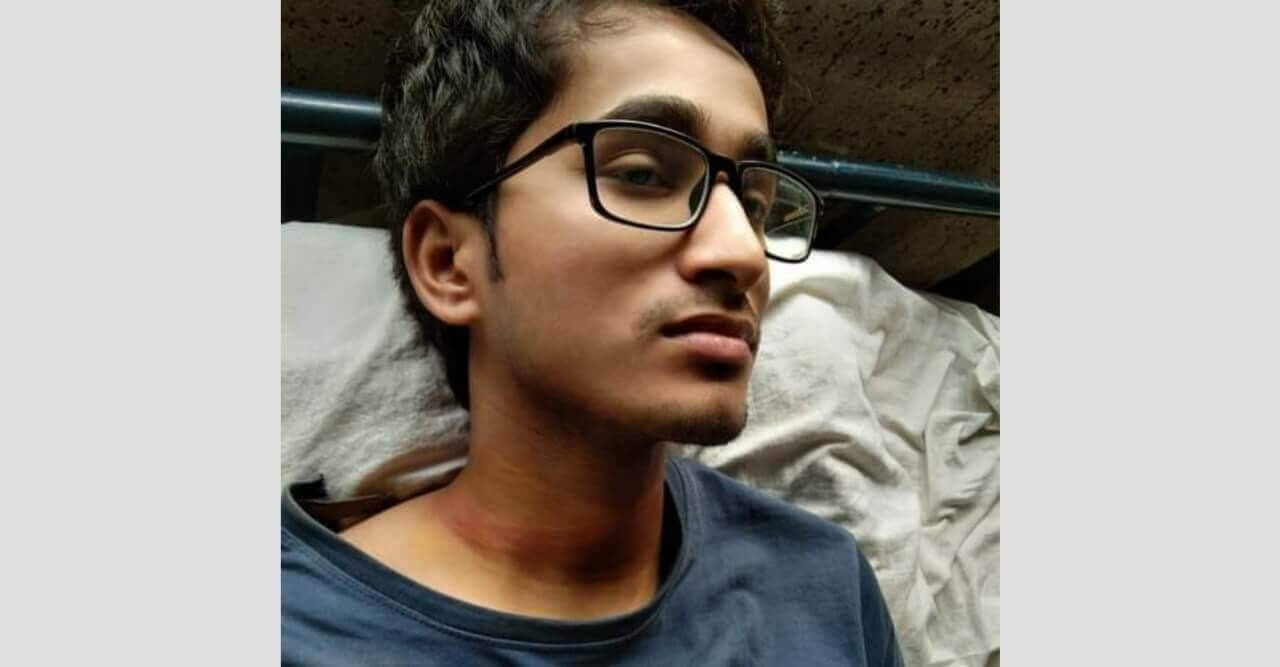 টিকা দিতে এসে কিশোর গ্যাংয়ের হামলার শিকার কলেজ শিক্ষার্থী