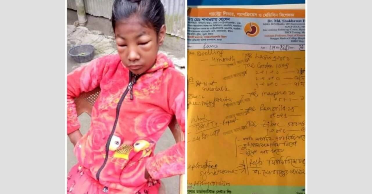 শিশু রুমির বাঁচার আকুতি