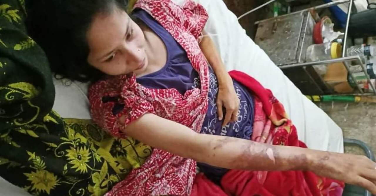 গুরুদাসপুরে দুই বোনকে মারধর ও পুড়িয়ে হত্যা চেষ্টার অভিযোগ