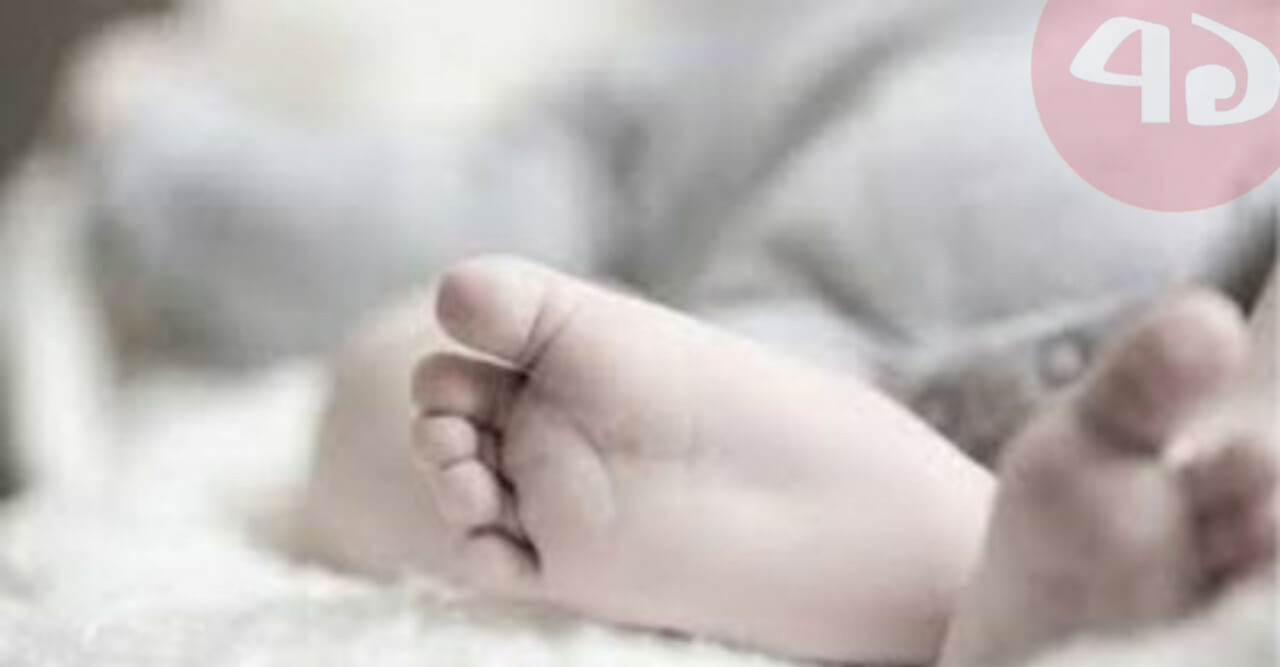 পাথরঘাটায় চোখ,নাক বিহীন শিশুটি আর নেই