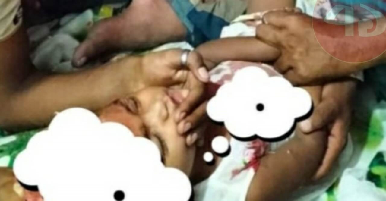 কুকুরের কামড়ে ৩ বছরের শিশু আহত, মাথায় ২২ সেলাই