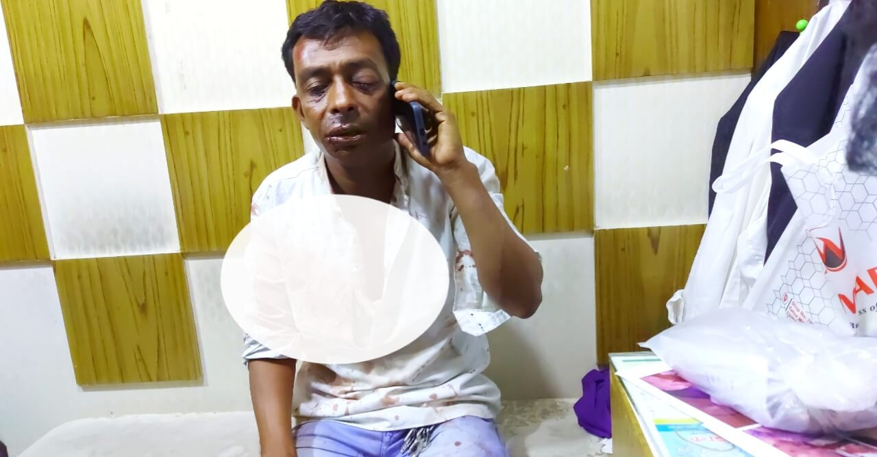 সন্ত্রাসীদের হামলায় গুরুতর আহত শ্রমিক নেতা