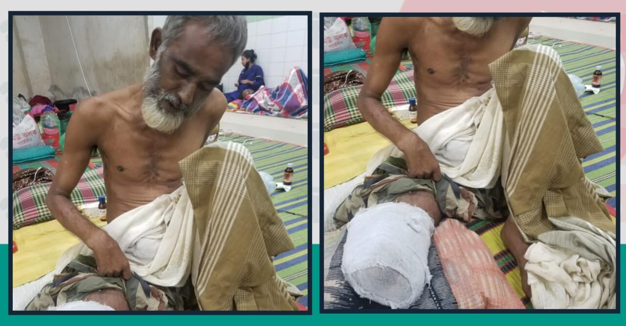 ট্রেনে পা কাটা ব্যক্তির  চিকিৎসায় অর্থের প্রয়োজন